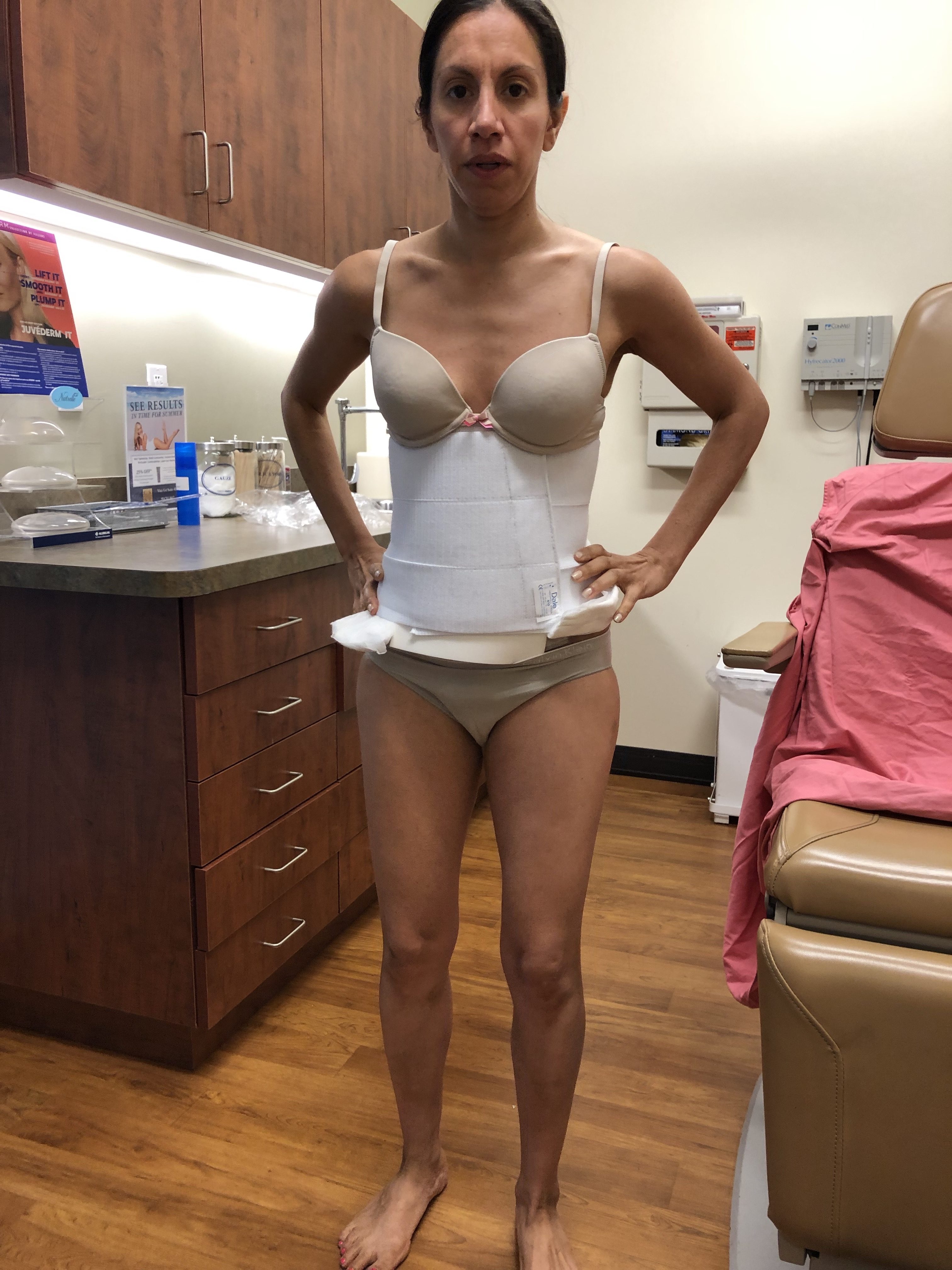 woman in body brace post tummy tuck